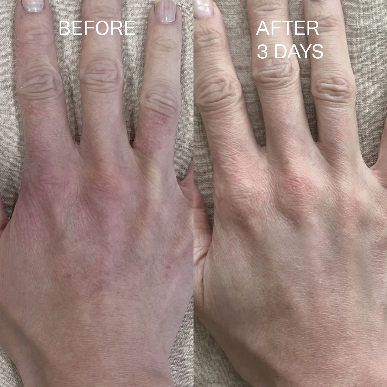 Beofre and after