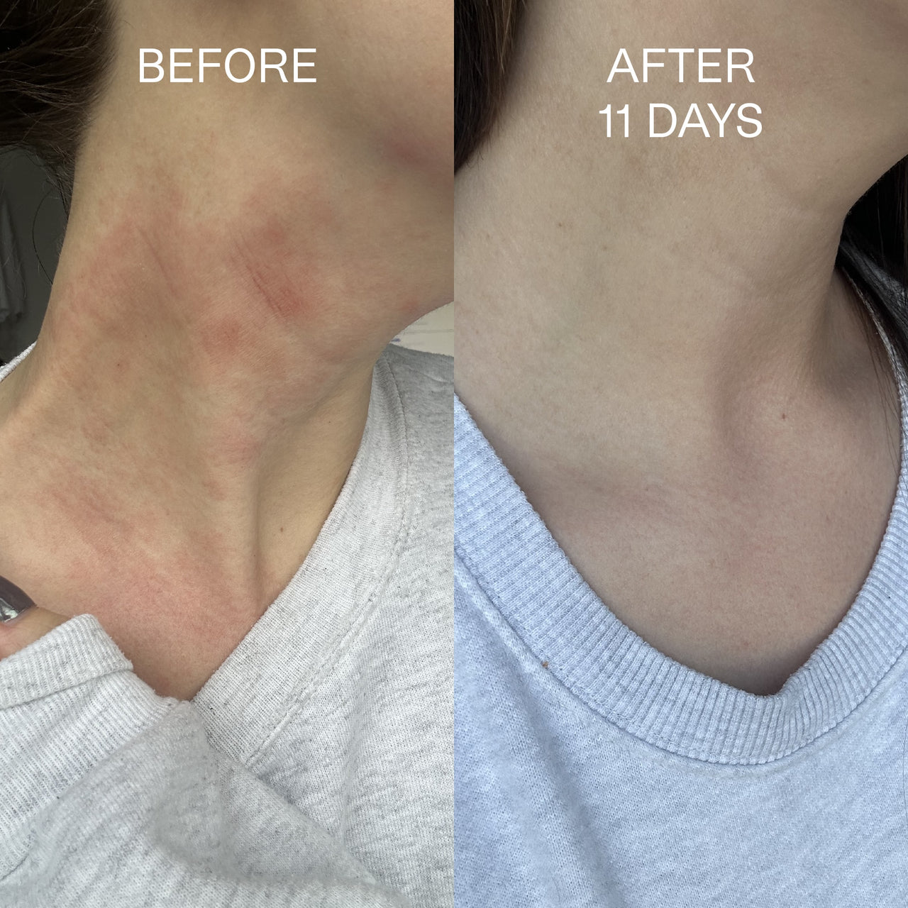 Beofre and after