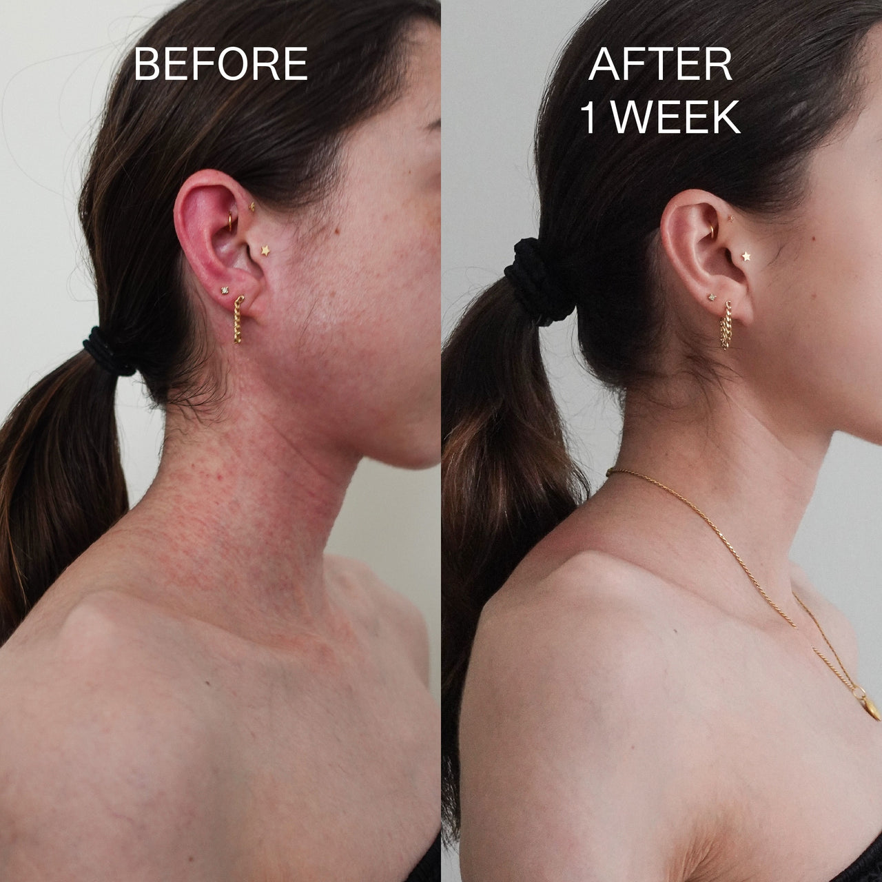 Beofre and after