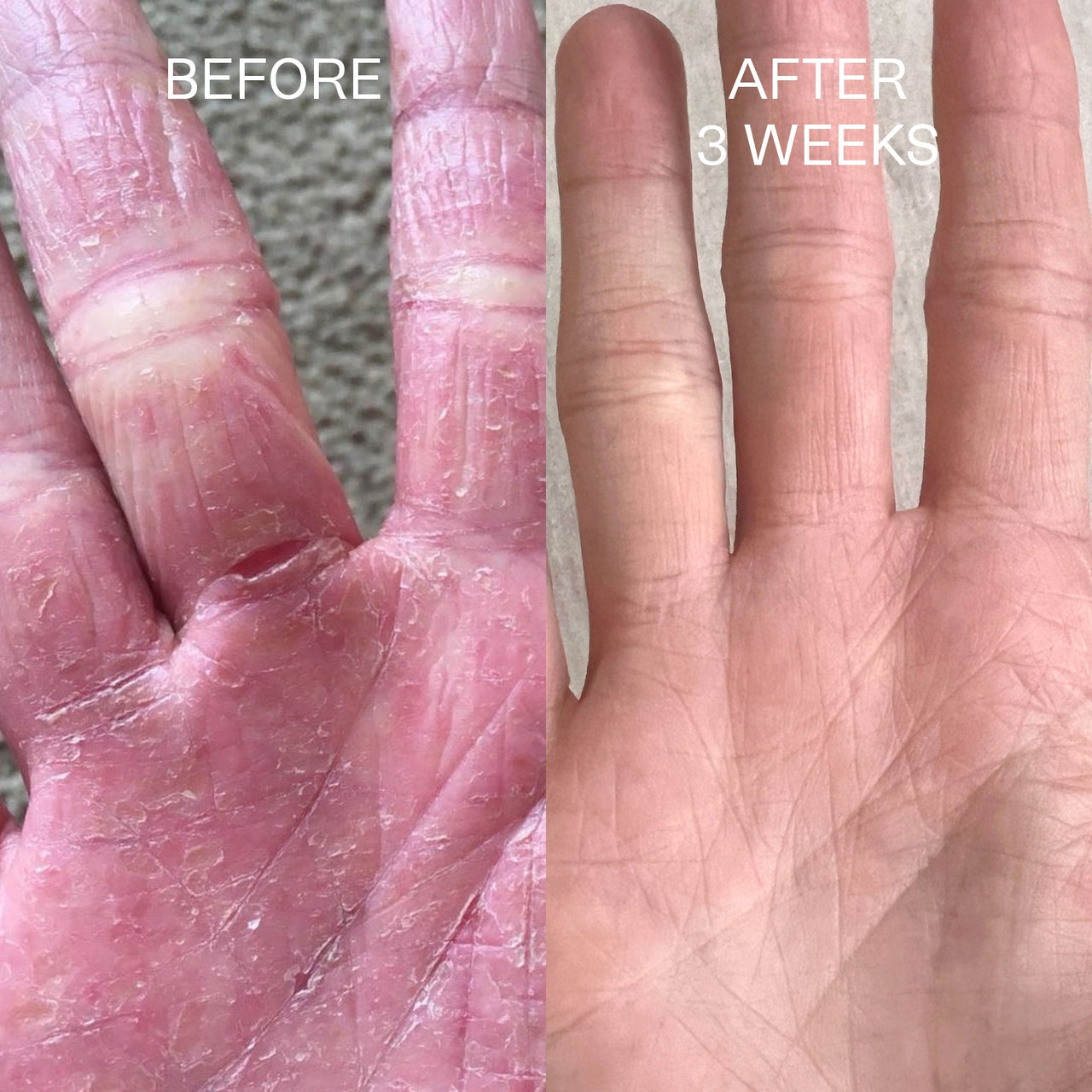 Beofre and after