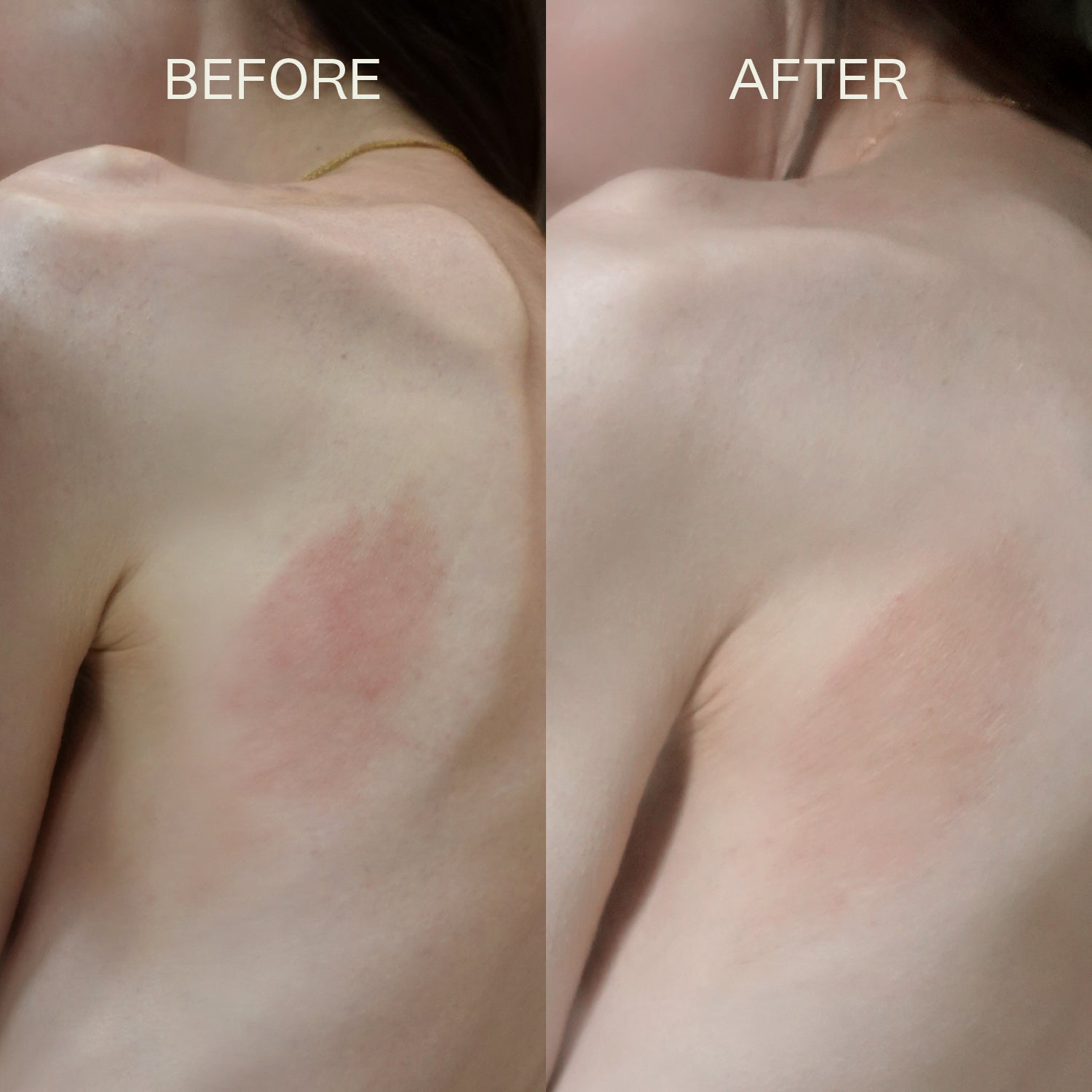 Therapy Healing Balm