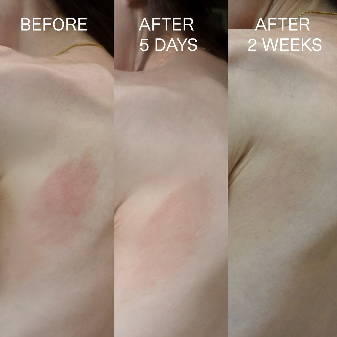 Beofre and after