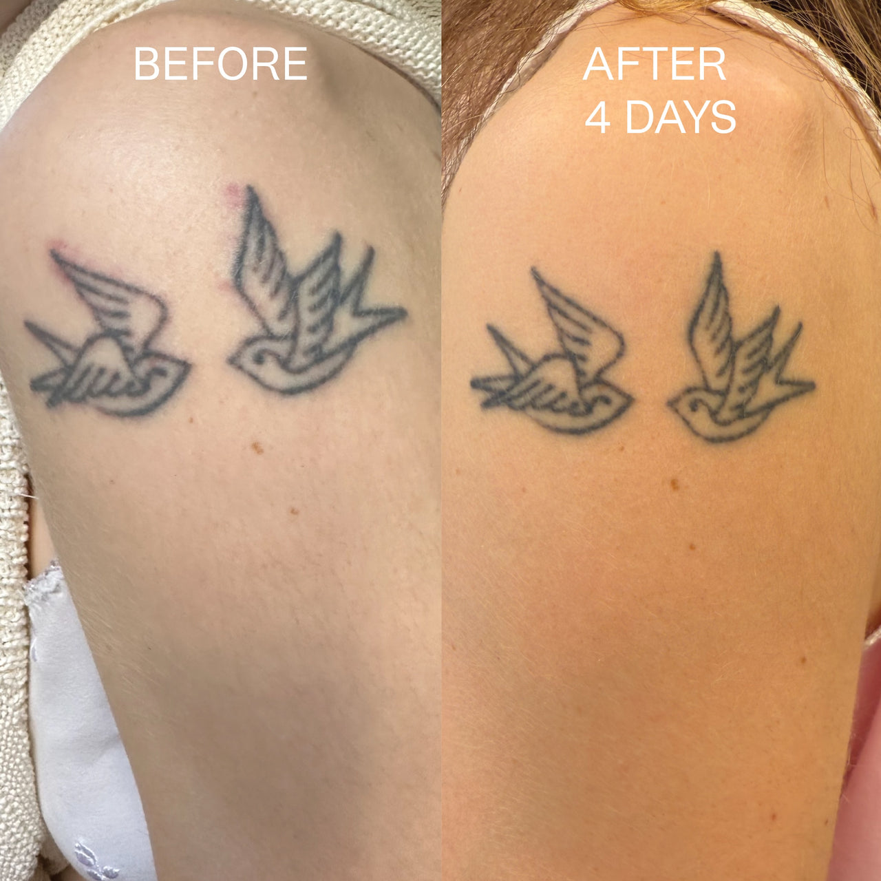 Beofre and after